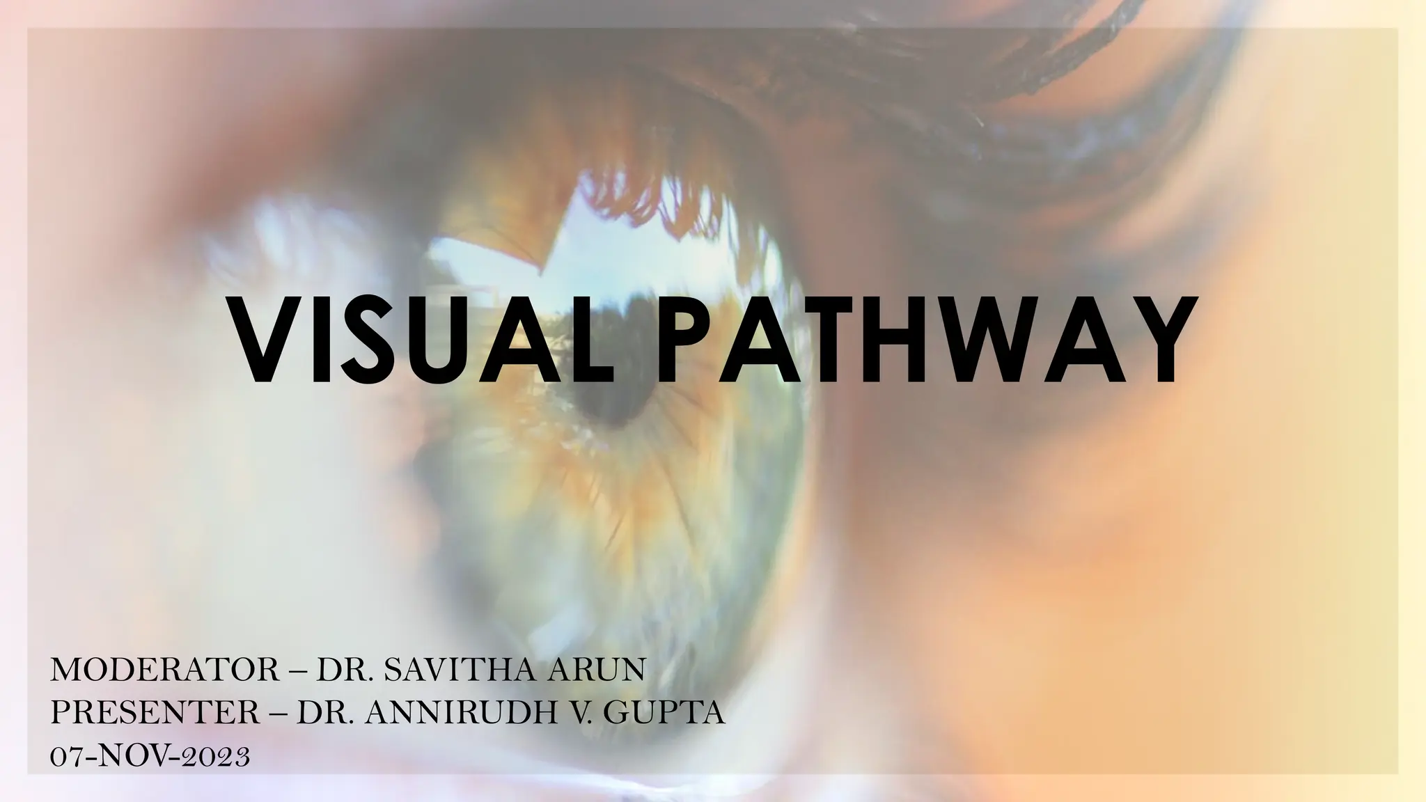 VISUAL PATHWAY and its related pathology | PPTX