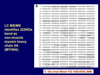 LC MS/MS identifies 225KDa band as  non-muscle  myosin heavy  chain IIA  (MYHIIA) C. Chu  et al . Blood 112: 5122-5129, 2008 