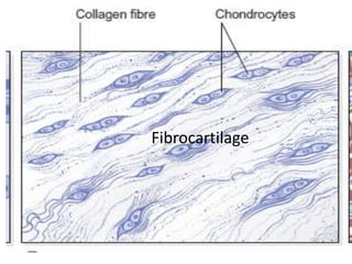 Fibrocartilage
 