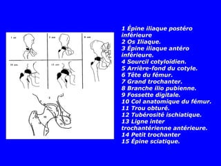 1 Épine iliaque postéro
inférieure
2 Os Iliaque.
3 Épine iliaque antéro
inférieure.
4 Sourcil cotyloïdien.
5 Arrière-fond du cotyle.
6 Tête du fémur.
7 Grand trochanter.
8 Branche ilio pubienne.
9 Fossette digitale.
10 Col anatomique du fémur.
11 Trou obturé.
12 Tubérosité ischiatique.
13 Ligne inter
trochantérienne antérieure.
14 Petit trochanter
15 Épine sciatique.
 