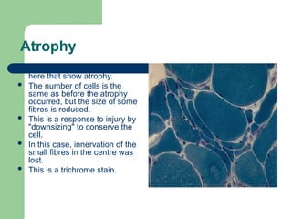 01-CELL INJURY 1.ppt for pathology it is easy | PPT