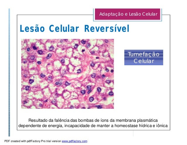 Cardiologia Nuclear na Insuficiência Cardíaca: Que ...