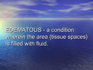 EDEMATOUS - a conditionEDEMATOUS - a condition
wherein the area (tissue spaces)wherein the area (tissue spaces)
is filled with fluid.is filled with fluid.
 