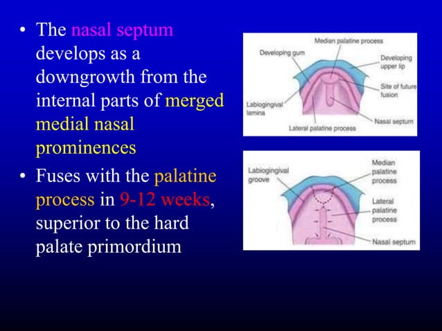 Development of Face, oral cavity and pharyngeal arches .ppt | Ear, Nose ...
