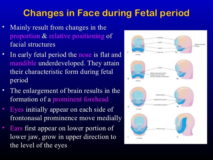 photo of 31 week fetus