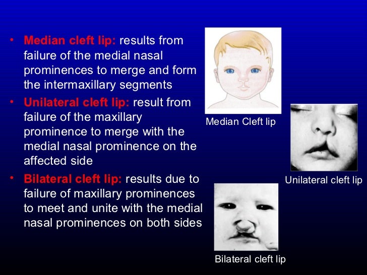 Development of the Face, Oral Cavity & Pharyngeal arches