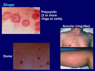 Diagnosis of skin disorders and how to deal.ppt