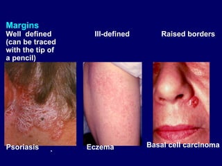 Diagnosis of skin disorders and how to deal.ppt