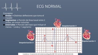 Comprehensive Guide to Electrocardiogram (ECG) Interpretation and ...