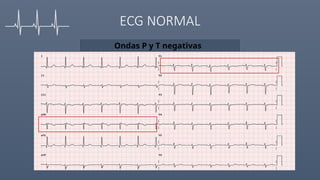 Comprehensive Guide to Electrocardiogram (ECG) Interpretation and ...