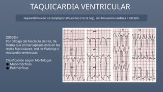 Multiple Pathologies Ecg Comprehensive Guide to Electrocardiogram (ECG) Interpretation and ...
