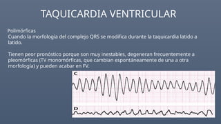 Multiple Pathologies Ecg Comprehensive Guide to Electrocardiogram (ECG) Interpretation and ...