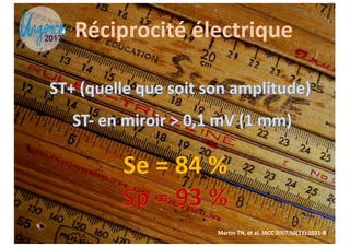 Strategie Diagnostique Ecg Dans Le Sca