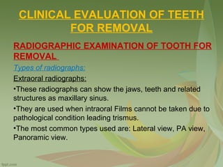CLINICAL EVALUATION OF TEETH
FOR REMOVAL
RADIOGRAPHIC EXAMINATION OF TOOTH FOR
REMOVAL
Types of radiographs:
Extraoral radiographs:
•These radiographs can show the jaws, teeth and related
structures as maxillary sinus.
•They are used when intraoral Films cannot be taken due to
pathological condition leading trismus.
•The most common types used are: Lateral view, PA view,
Panoramic view.
 