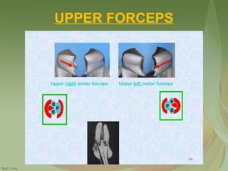 UPPER FORCEPS
 