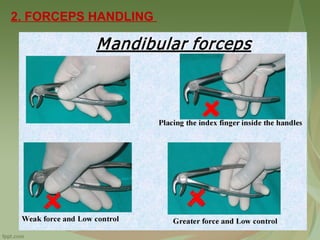 2. FORCEPS HANDLING
 