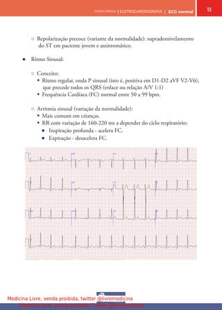 13
CLÍNICA MÉDICA | ELETROCARDIOGRAFIA | ECG normal
○ Repolarização precoce (variante da normalidade): supradesnivelamento
do ST em paciente jovem e assintomático.
● Ritmo Sinusal:
○ Conceito:
§ Ritmo regular, onda P sinusal (isto é, positiva em D1-D2 aVF V2-V6),
que precede todos os QRS (enlace ou relação A/V 1:1)
§ Frequência Cardíaca (FC) normal entre 50 a 99 bpm.
○ Arritmia sinusal (variação da normalidade):
§ Mais comum em crianças.
§ RR com variação de 160-220 ms a depender do ciclo respiratório:
● Inspiração profunda - acelera FC.
● Expiração - desacelera FC.
Medicina Livre, venda proibida, twitter @livremedicina
Medicina livre, venda proibida. Twitter @livremedicina
 