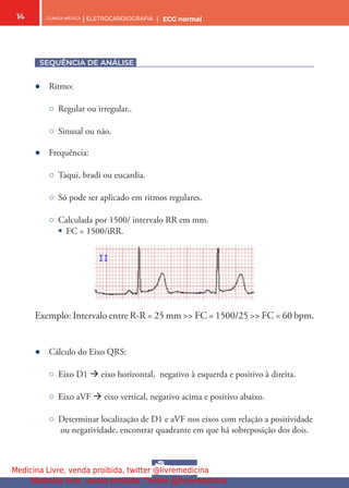 CLÍNICA MÉDICA | ELETROCARDIOGRAFIA | ECG normal
14
SEQUÊNCIA DE ANÁLISE
● Ritmo:
○ Regular ou irregular..
○ Sinusal ou não.
● Frequência:
○ Taqui, bradi ou eucardia.
○ Só pode ser aplicado em ritmos regulares.
○ Calculada por 1500/ intervalo RR em mm.
§ FC = 1500/iRR.
Exemplo: Intervalo entre R-R = 25 mm >> FC = 1500/25 >> FC = 60 bpm.
● Cálculo do Eixo QRS:
○ Eixo D1  eixo horizontal, negativo à esquerda e positivo à direita.
○ Eixo aVF  eixo vertical, negativo acima e positivo abaixo.
○ Determinar localização de D1 e aVF nos eixos com relação a positividade
ou negatividade, encontrar quadrante em que há sobreposição dos dois.
Medicina Livre, venda proibida, twitter @livremedicina
Medicina livre, venda proibida. Twitter @livremedicina
 