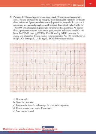 17
CLÍNICA MÉDICA | ELETROCARDIOGRAFIA | ECG normal
2) Paciente de 72 anos, hipertenso, ex-tabagista de 40 maços-ano (cessou há 3
anos). Faz uso ambulatorial de enalapril, hidroclorotiazida e atenolol (todos em
doses máximas). Apresentava bom controle pressórico, contudo, há cerca de 6
meses vem apresentando medidas residenciais de PA mais elevadas (média de
190x100) sem alterações da prescrição e mantendo boa aderência. Ao exame
físico, apresentando-se em bom estado geral, corado, hidratado, com FC=101
bpm, PA 192x96 mmHg (MSD) e 194x94 mmHg (MSE) e restante do
exame sem alterações. Trouxe exames complementares: Na: 139 mEq/L, K: 4,9
mEq/L, Cr: 1,0 mg/dL, U: 40 mg/dL. ECG demonstrado abaixo.
a) Dextrocardia
b) Troca de eletrodos
c) Taquicardia sinusal e sobrecarga de ventrículo esquerdo
d) Ritmo sinusal com ondas T cerebrais
e) Área inativa lateral
Medicina Livre, venda proibida, twitter @livremedicina
Medicina livre, venda proibida. Twitter @livremedicina
 
