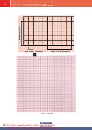 CLÍNICA MÉDICA | ELETROCARDIOGRAFIA | ECG normal
4
Medicina Livre, venda proibida, twitter @livremedicina
Medicina livre, venda proibida. Twitter @livremedicina
 