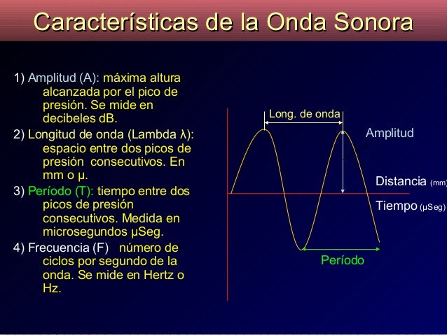 Resultado de imagen para ondas sonoras caracteristicas