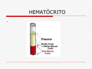 HEMATÓCRITO
.
 