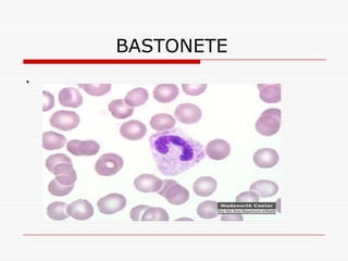 BASTONETE
.
 