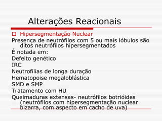Alterações Reacionais
 Hipersegmentação Nuclear
Presença de neutrófilos com 5 ou mais lóbulos são
   ditos neutrófilos hipersegmentados
É notada em:
Defeito genético
IRC
Neutrofilias de longa duração
Hematopoise megaloblástica
SMD e SMP
Tratamento com HU
Queimaduras extensas- neutrófilos botrióides
   (neutrófilos com hipersegmentação nuclear
   bizarra, com aspecto em cacho de uva)
 