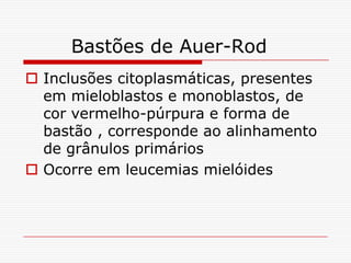 Bastões de Auer-Rod
 Inclusões citoplasmáticas, presentes
  em mieloblastos e monoblastos, de
  cor vermelho-púrpura e forma de
  bastão , corresponde ao alinhamento
  de grânulos primários
 Ocorre em leucemias mielóides
 