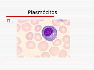 Plasmócitos
.
 