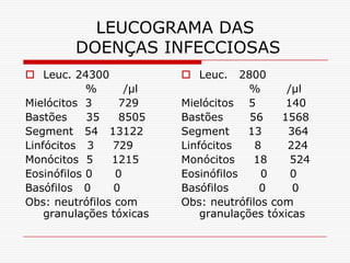 LEUCOGRAMA DAS
         DOENÇAS INFECCIOSAS
 Leuc. 24300              Leuc.     2800
            %      /µl                 %      /µl
Mielócitos 3      729     Mielócitos 5        140
Bastões     35    8505    Bastões       56   1568
Segment 54 13122          Segment      13     364
Linfócitos 3    729       Linfócitos     8    224
Monócitos 5     1215      Monócitos      18    524
Eosinófilos 0    0        Eosinófilos     0    0
Basófilos 0      0        Basófilos       0    0
Obs: neutrófilos com      Obs: neutrófilos com
    granulações tóxicas       granulações tóxicas
 