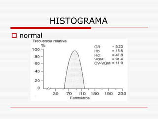 HISTOGRAMA
 normal
 