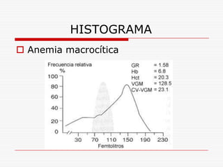 HISTOGRAMA
 Anemia macrocítica
 