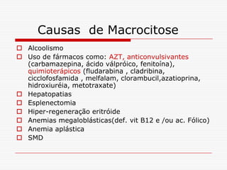 Causas de Macrocitose
 Alcoolismo
 Uso de fármacos como: AZT, anticonvulsivantes
  (carbamazepina, ácido válpróico, fenitoína),
  quimioterápicos (fludarabina , cladribina,
  cicclofosfamida , melfalam, clorambucil,azatioprina,
  hidroxiuréia, metotraxate)
 Hepatopatias
 Esplenectomia
 Hiper-regeneração eritróide
 Anemias megaloblásticas(def. vit B12 e /ou ac. Fólico)
 Anemia aplástica
 SMD
 