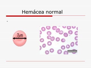 Hemácea normal
.
 