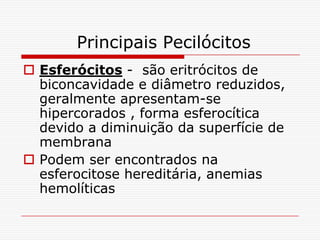Principais Pecilócitos
 Esferócitos - são eritrócitos de
  biconcavidade e diâmetro reduzidos,
  geralmente apresentam-se
  hipercorados , forma esferocítica
  devido a diminuição da superfície de
  membrana
 Podem ser encontrados na
  esferocitose hereditária, anemias
  hemolíticas
 