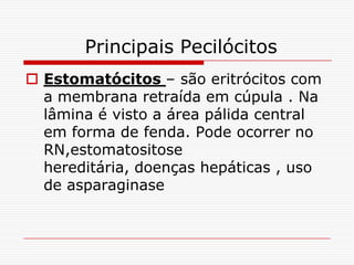 Principais Pecilócitos
 Estomatócitos – são eritrócitos com
  a membrana retraída em cúpula . Na
  lâmina é visto a área pálida central
  em forma de fenda. Pode ocorrer no
  RN,estomatositose
  hereditária, doenças hepáticas , uso
  de asparaginase
 