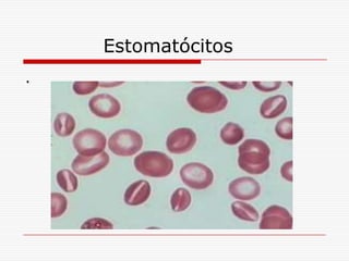 Estomatócitos
.
 
