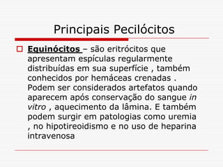 Principais Pecilócitos
 Equinócitos – são eritrócitos que
  apresentam espículas regularmente
  distribuídas em sua superfície , também
  conhecidos por hemáceas crenadas .
  Podem ser considerados artefatos quando
  aparecem após conservação do sangue in
  vitro , aquecimento da lâmina. E também
  podem surgir em patologias como uremia
  , no hipotireoidismo e no uso de heparina
  intravenosa
 