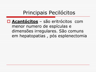 Principais Pecilócitos
 Acantócitos – são eritrócitos com
  menor numero de espículas e
  dimensões irregulares. São comuns
  em hepatopatias , pós esplenectomia
 