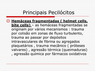 Principais Pecilócitos
 Hemáceas fragmentadas ( helmet cells,
  bite cells) – as hemáceas fragmentadas se
  originam por vários mecanismos : trauma
  por colisão em zonas de fluxo turbulento,
  trauma ao passar por depósitos
  intravasculares de fibrina ou agregados
  plaquetários , trauma mecânico ( próteses
  valvares) , agressão térmica (queimaduras)
  , agressão química por fármacos oxidativos
 