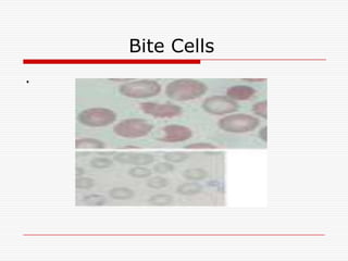 Bite Cells
.
 
