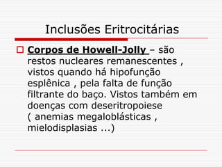 Inclusões Eritrocitárias
 Corpos de Howell-Jolly – são
  restos nucleares remanescentes ,
  vistos quando há hipofunção
  esplênica , pela falta de função
  filtrante do baço. Vistos também em
  doenças com deseritropoiese
  ( anemias megaloblásticas ,
  mielodisplasias ...)
 