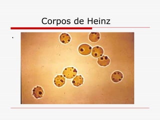 Corpos de Heinz
.
 