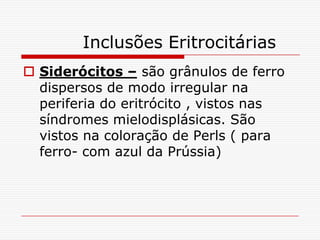 Inclusões Eritrocitárias
 Siderócitos – são grânulos de ferro
  dispersos de modo irregular na
  periferia do eritrócito , vistos nas
  síndromes mielodisplásicas. São
  vistos na coloração de Perls ( para
  ferro- com azul da Prússia)
 