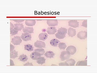 Babesiose
.
 