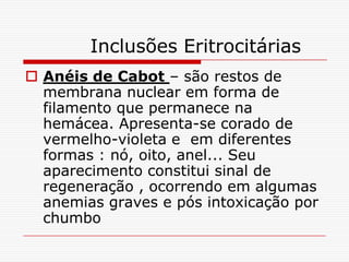 Inclusões Eritrocitárias
 Anéis de Cabot – são restos de
  membrana nuclear em forma de
  filamento que permanece na
  hemácea. Apresenta-se corado de
  vermelho-violeta e em diferentes
  formas : nó, oito, anel... Seu
  aparecimento constitui sinal de
  regeneração , ocorrendo em algumas
  anemias graves e pós intoxicação por
  chumbo
 