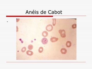 Anéis de Cabot
.
 