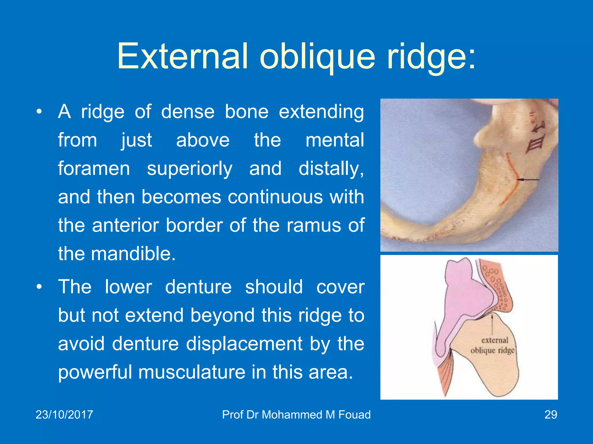 Intraoral Anatomical Landmarks | PDF