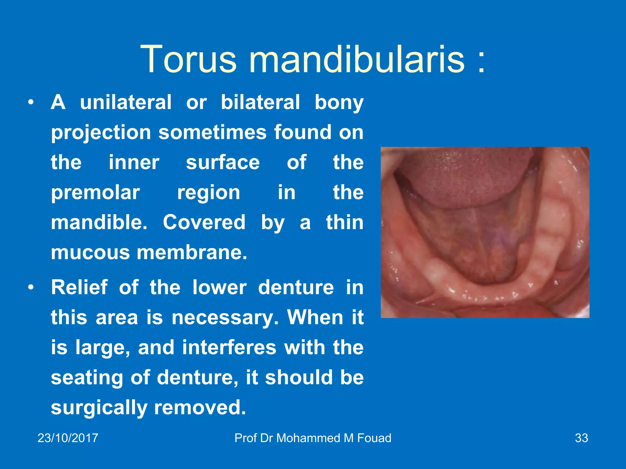 Intraoral Anatomical Landmarks | PDF